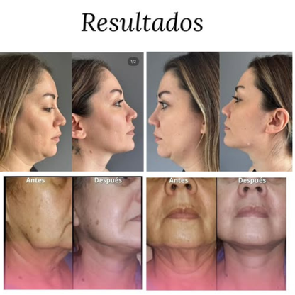 PACK COLAGENIX & GLOWLUX™