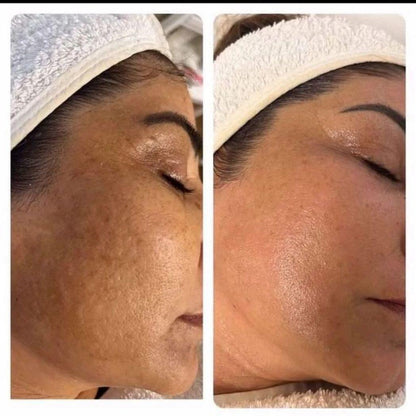 Crema con Niacinamida para Poros Más Finos, Hidratación y Piel Luminosa